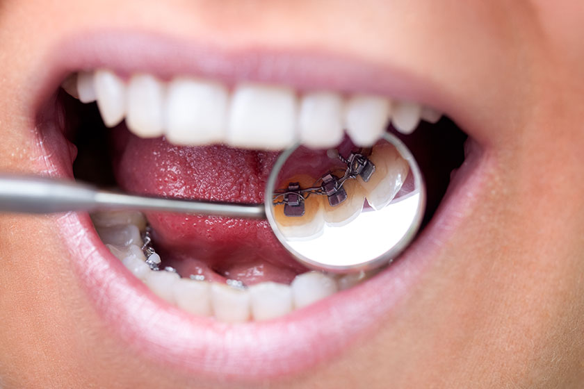 Ne zaman ortodontik muayene olunmalı?