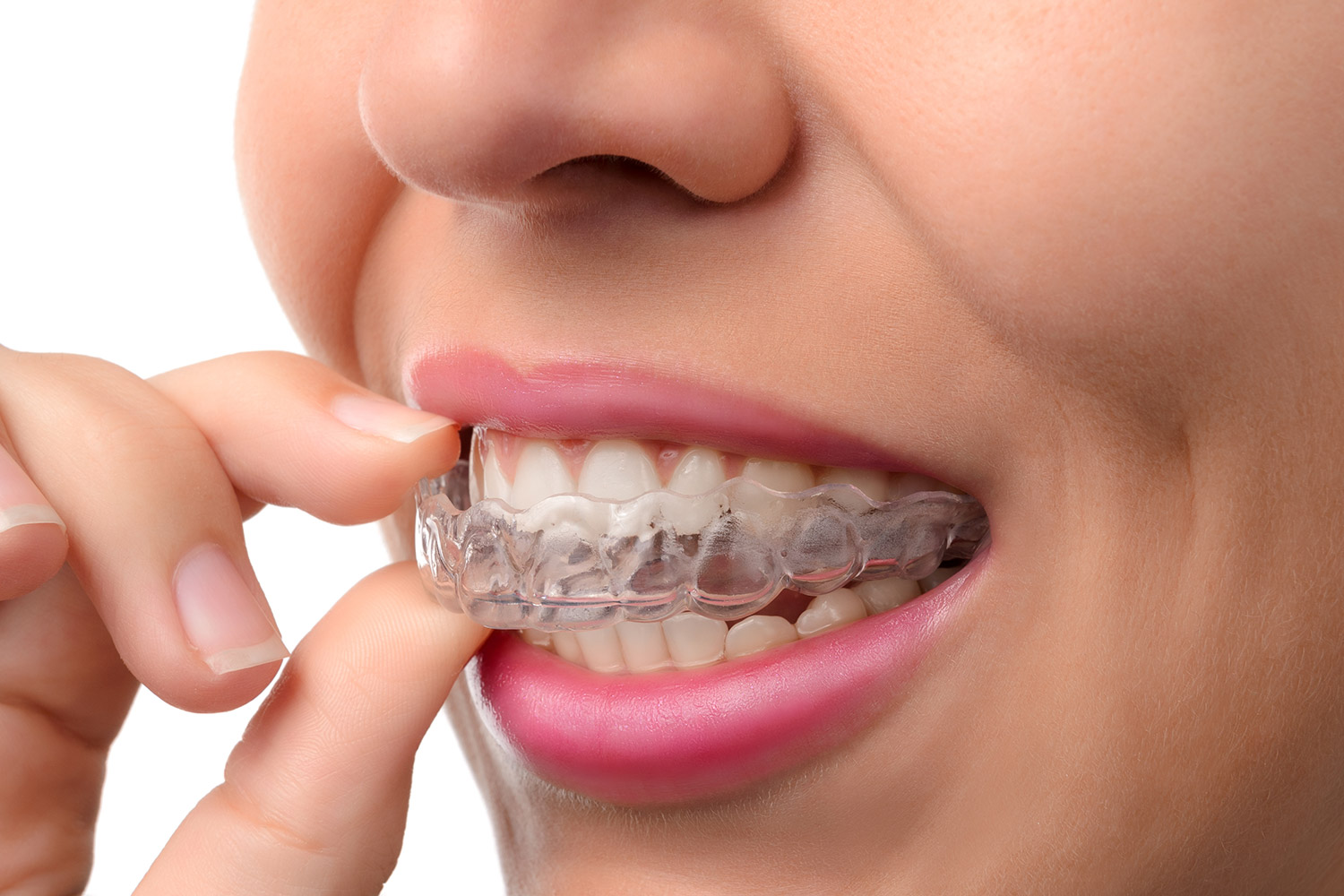Ortodontik tedavi pahalı mıdır?